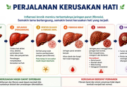 Deteksi Dini Jadi Kunci, Kerusakan Hati Bisa Dicegah Sejak Awal